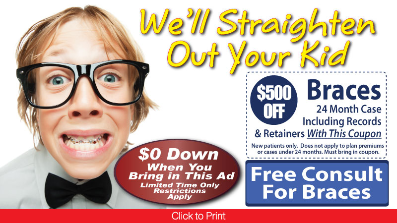 $500 Off Braces Coupon